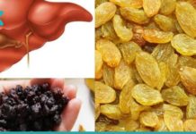 აი, როგორ უნდა გაისუფთაოთ ღვიძლი ქიშმიშით 2 დღეში -ეფექტური მეთოდი!