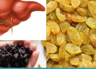 აი, როგორ უნდა გაისუფთაოთ ღვიძლი ქიშმიშით 2 დღეში -ეფექტური მეთოდი!