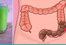 გამოდევნე ორგანიზმიდან ტოქსინები და ცხიმები სულ რაღაც 48 საათში! უმარტივესი დიეტა!