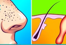 შავი წერტილების მოშორების ყველაზე ეფექტური მეთოდები. ეს ნიღბები შავ წერტილებს სამუდამოდ გაგიქრობენ