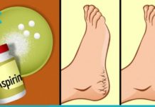 ეს წამალი მშრალ და დახეთქილ ფეხებს 10 დღეში კურნავს! ნეტავ ადრე მცოდნოდა !