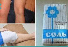 მარილის სახვევი – მეთოდი, რომელიც კიბოს უჯრედებსაც კი კლავს. ამის შესახებ ცოტამ იცის