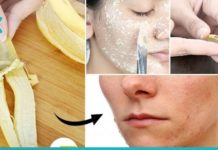ბანანის ქერქის გამოყენების 7 გზა, რომლის წაკითხვის შემდეგ მას აღარ გადააგდებთ.