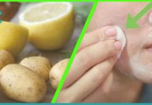 კარტოფილის უნიკალური ნიღბები სახის კანისთვის. იაფი და ეფექტური საშუალება