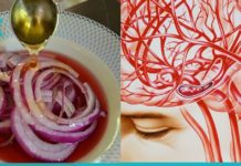 გაიწმინდეთ თავის ტვინის სისხლძარღვები ამ ნატურალური რეცეპტების საშუალებით.