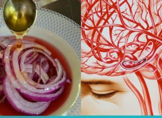 გაიწმინდეთ თავის ტვინის სისხლძარღვები ამ ნატურალური რეცეპტების საშუალებით.