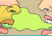 როგორ დავაღწიოთ თავი პირის ღრუში უსიამოვნო სუნს? გაითვალისწინეთ ეს რჩევები