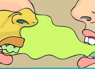 როგორ დავაღწიოთ თავი პირის ღრუში უსიამოვნო სუნს? გაითვალისწინეთ ეს რჩევები