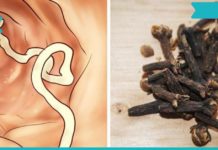 როგორ ვიმკურნალოთ ჭიებზე სახლის პირობებში? ეს მეთოდები საკმაოდ მარტივი და ეფექტურია