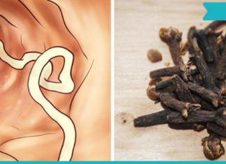 როგორ ვიმკურნალოთ ჭიებზე სახლის პირობებში? ეს მეთოდები საკმაოდ მარტივი და ეფექტურია