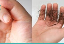 თუ თმა გცვივათ და ფრჩხილები გტყდებათ, მიიღეთ ეს ნაზავი