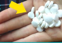 ასპირინის ხსნარი ვარიკოზული ვენებისა და ოსტეოქონდროზის დროს. მის ეფექტურობაში თავად დარწმუნდებით