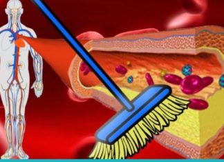 საკვები ნივთიერებები, რომლებიც ასუფთავებენ არტერიებს