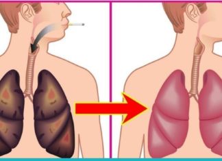 ფილტვების გასაწმენდი ელექსირი მწეველთათვის. გააკეთეთ ეს თქვენი ჯანმრთელობისთვის