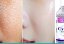 გამოიყენეთ გლიცერინი კრისტალურად სუფთა კანისთვის