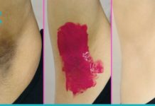 წაისვით ეს ვარდისფერი კრემი და დაემშვიდობეთ მუქ იღლიებს სამუდამოდ