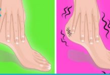 რატომ გვიბუჟდება და გვტკივა ფეხები? გაიგეთ გამომწვევი მიზეზებისა და მკურნალობის მეთოდების შესახებ