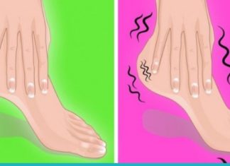 რატომ გვიბუჟდება და გვტკივა ფეხები? გაიგეთ გამომწვევი მიზეზებისა და მკურნალობის მეთოდების შესახებ
