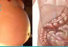 გათავისუფლდით გაზებისა და მუცლის შებერილობისგან სწრაფად და ეფექტურად ამ 7 საშუალებით!