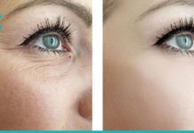 დაიჭიმეთ კანი თვალების გარშემო ქირურგიული ჩარევების გარეშე. ნაოჭები და სიშავეები გაქრება!