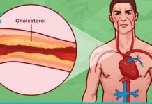 მაღალი არტერიული წნევა, ქოლესტერინის მაღალი დონე და მრავალი სხვა დაავადება მყისიერად გაქრება. საუკეთესო რეცეპტი!