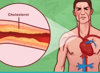 მაღალი არტერიული წნევა, ქოლესტერინის მაღალი დონე და მრავალი სხვა დაავადება მყისიერად გაქრება. საუკეთესო რეცეპტი!