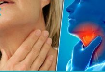 უმკურნალეთ ყელის ტკივილს ამ ნატურალური საშუალებებით. ამის შემდეგ მედიკამენტებზე უარს იტყვით