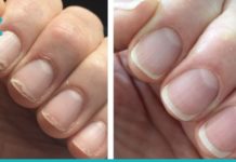 ამ ქალმა მოამზადა ეს ნარევი ფრჩხილებისთვის და რამდენიმე კვირაში დაუჯერებელი შედეგი მიიღო!