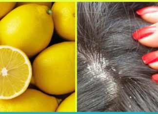 ეს ნატურალური საშუალებები ქერტლს რამდენიმე დღეში მოგაშორებენ. უბრალოდ სცადეთ!