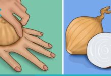 ამ ქალმა ხელზე უმი ხახვი დაიდო და საოცარი შედეგი მიიღო. ეს თქვენც გამოგადგებათ