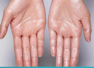 ეს უნდა წაიკითხოთ: როგორ ხდება ბუნებრივი გზით ოფლიანობის თავიდან აცილება!