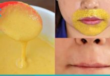 როგორ მოვიშოროთ ტუჩზედა თმა? ამაში ეს მეთოდები დაგეხმარებათ