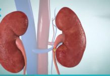 სამუდამოდ დაემშვიდობეთ თირკმელებში კენჭებს, მას შემდეგ რაც ამ სასმელს ნახევარ ჭიქას დალევთ.