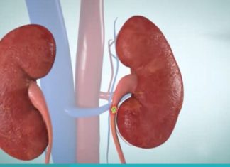 სამუდამოდ დაემშვიდობეთ თირკმელებში კენჭებს, მას შემდეგ რაც ამ სასმელს ნახევარ ჭიქას დალევთ.