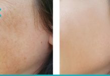 სახიდან ნაოჭები გაქრება რამდენიმე დღეში და თქვენი კანი გახდება საოცრად გლუვი. სცადეთ ეს ნიღბები!