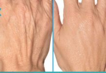 ნატურალური რეცეპტები ხელის კანისთვის. დაუბრუნეთ თქვენს კანს ახალგაზრდობა