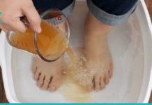 ძმრის აბაზანას შეუძლია შეამსუბუქოს ფეხის დაავადებები. გაიგეთ მეტი