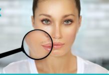 მოიშორეთ სახესა და სხეულზე არასასურველი თმა ამ მარტივი რეცეპტით