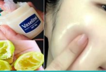 ვაზელინი და ლიმონი სამუდამოდ გაგიქრობთ ლაქებს კანიდან