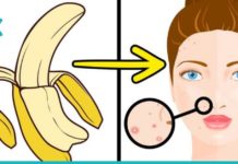 გამოიყენეთ ბანანის ქერქი კანის გასაჯანსაღებლად