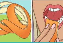 კბილების გათეთრების ბუნებრივი და მარტივი ხერხები