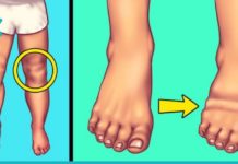 რა შეიძლება გამოიწვიოს მარილის ჭარბმა მოხმარებამ? ეს უნდა იცოდეთ