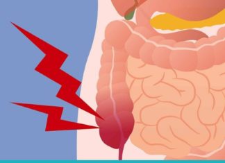 გაწმინდეთ მსხვილი ნაწლავი ამ სასმელის საშუალებით