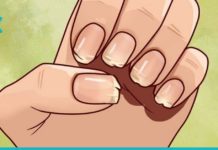 სუსტი და მტვრევადი ფრჩხილების მკურნალობა სახლის პირობებში