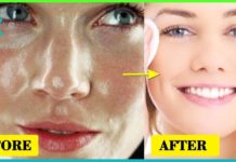 თუ ცხიმიანი და პრობლემური კანი გაქვთ, სცადეთ ეს ნიღბები. შედეგით გაოცებული დარჩებით