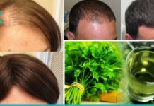 როგორ შევიჩეწროთ თმის ცვენა? საუკეთესო მეთოდები ამ პრობლემის მოსაგვარებლად