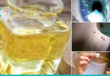 აბუსალათინის ზეთი ამ 18 პრობლემას მოგიგვარებთ. ეს ზეთი ყველას უნდა ჰქონდეს სახლში