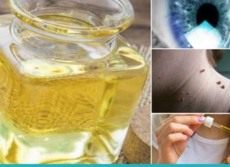 აბუსალათინის ზეთი ამ 18 პრობლემას მოგიგვარებთ. ეს ზეთი ყველას უნდა ჰქონდეს სახლში