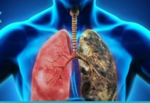 6 პროდუქტი, რომელიც გამოდევნის ნიკოტინს თქვენი ორგანიზმიდან