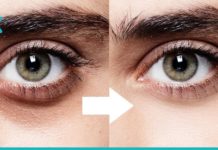 მოამზადეთ ეს ნიღაბი და სამუდამოდ დაემშვიდობეთ თვალების ირგვლივ შავ წრეებს